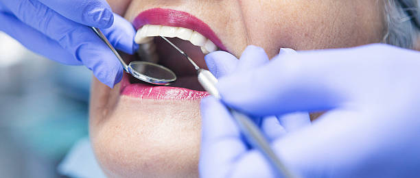 Best Knocked-Out Tooth Emergency  in Lake Wylie, SC